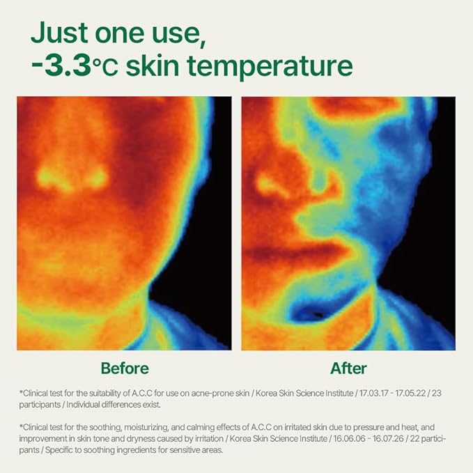 Pyunkang Yul PKY Ultimate Calming Solution Toner Pad for Sensitive Skin with Patented Ingredients, Intensely Calms & Soothes Rednes with CICA & Tea Tree, Korean Skincare (70 Pads)