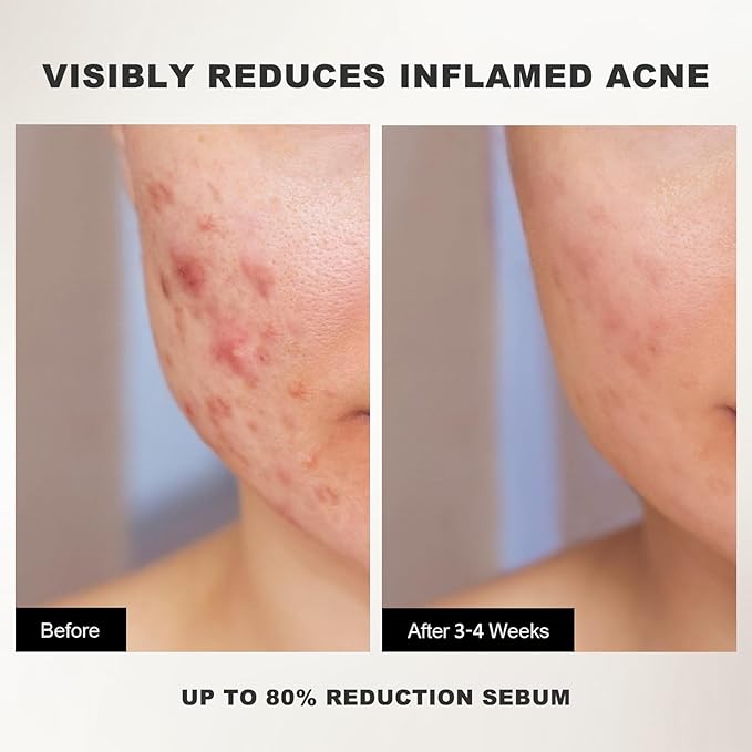 Peel Shot White Rice Peeling Ampoule - Soft Exfoliating Face and Body Scrub - Rice Exfoliator for Face Dead Skin Remover for Body - Deep Pore Cleanser Facial Scrub Exfoliator for All Skin Types