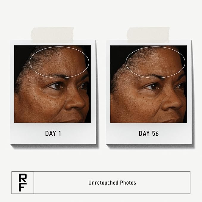 Rodan + Fields Redefine Daily Face Clay Cleanser (125 mL) | Advanced Skin Care | Exfoliating Face Wash & Face Mask for Sensitive Skin | Anti-Aging Face Cleanser for Women and Men